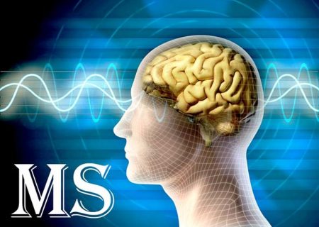 ۹۵۰ بیمار مبتلا به ام‌ اس در هرمزگان شناسایی شده است